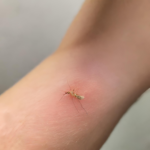 Can I get Chikungunya from a mosquito bite in Antigua?